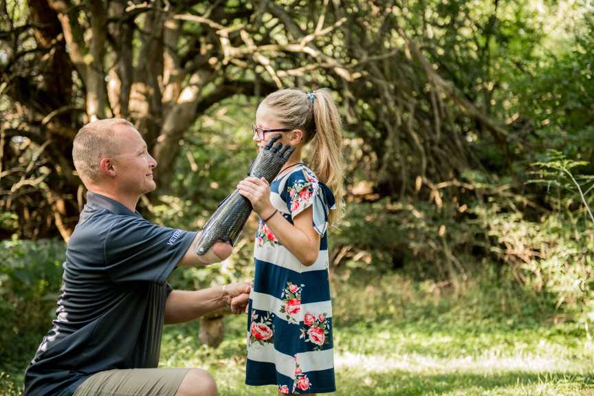 Prosthetic technology has come a long way – helping amputees regain a sense of touch
