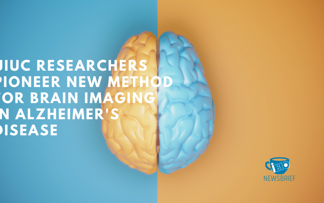 UIUC Researchers Pioneer New Method for Brain Imaging in Alzheimer’s Disease