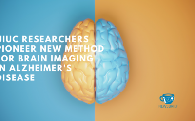 UIUC Researchers Pioneer New Method for Brain Imaging in Alzheimer’s Disease